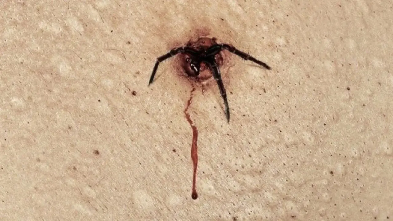 The Plague